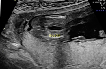 Gender scan 