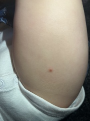Spots on legs… what are they?!?! 