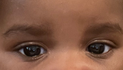 Please be kind. Small Eyes?