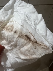 Spotting and cramping approx 5 weeks pregnant (TW possible TMI!)