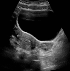 Due May 2023 - thread two