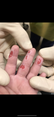 Being blamed for sons injury 