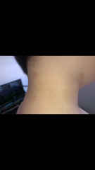 Could this be ringworm? 
