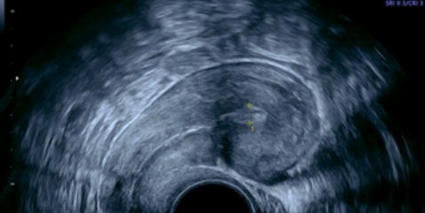 Post c section mamas advice please!