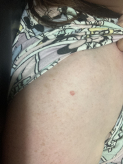 Little skin growth