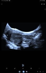 Due May 2023 - thread two