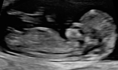 Due April/May after MC 🌈