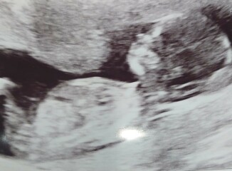 Due April/May after MC 🌈