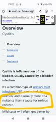 to ask if you have some secret weapon against cystitis after sex? 