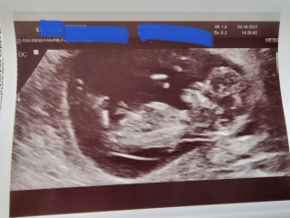 Has anyone been told the gender at 12 week scan?