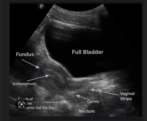 Due May 2023 - thread two