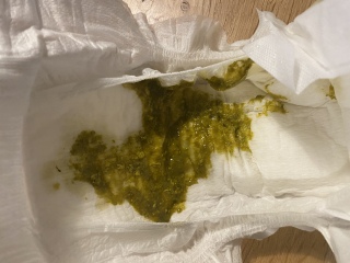 Green Poo!