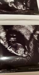 12 week gender prediction