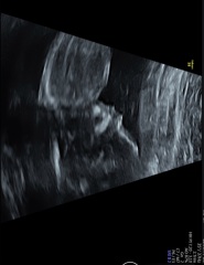 Guesses on Gender?