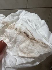 Please help! Spotting with clots and cramping - normal or miscarriage? *TW graphic photos*