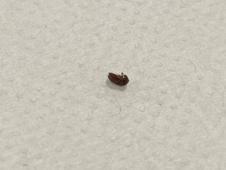 Are these bedbugs??