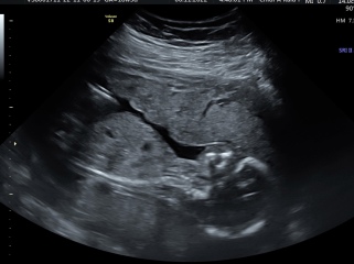 Girl or boy? Potty shot 