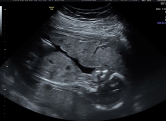 Girl or boy? Potty shot 