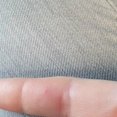 Anyone good at identifying weird finger bumps? 