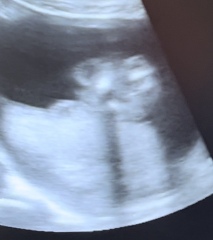Is this a boy or girl?