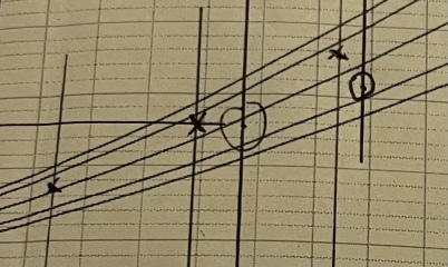 growth scans - dropped percentiles 