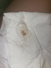 Is this implantation bleed or period - PIC ATTACHED