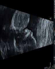 Guesses on Gender?