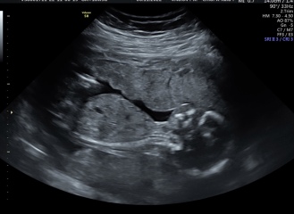 Girl or boy? Potty shot 