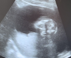 Is this a boy or girl?