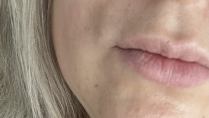 What’s this mark on my face? 