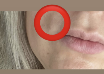 What’s this mark on my face? 