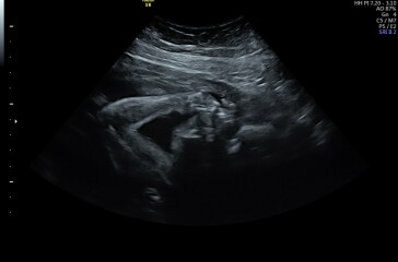 Due March 2023 - thread 5