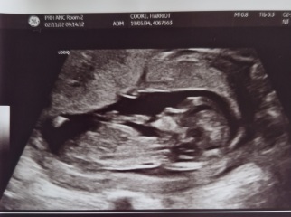 Gender guesses because I'm impatient!