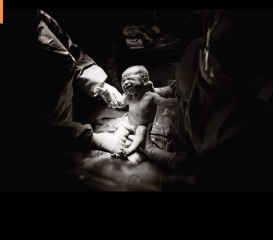 Birth photography? 