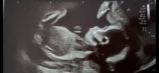 Does this look like a Boy to you?