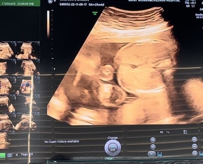 Recorded Video While Anomaly Scan