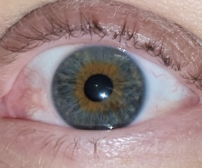 Eye pupil