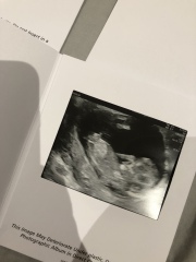 June 2023 Babies ☀️ (Thread 3) 