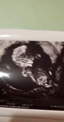 12 week gender prediction
