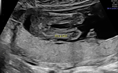 Gender scan 