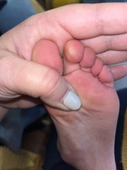 What is this on my child's toe (photos)
