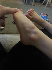 Foot lumps in 5 year old 