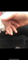 Being blamed for sons injury 