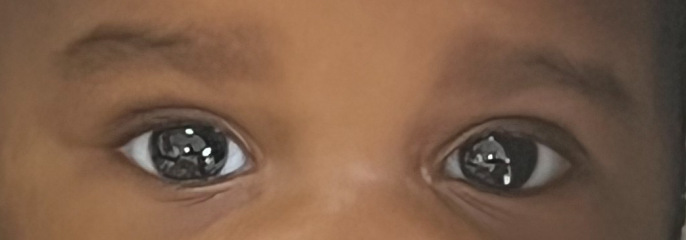 Please be kind. Small Eyes?