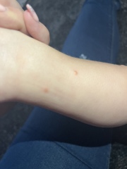 Spots on legs… what are they?!?! 