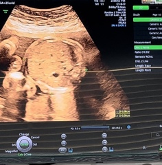 Gender guesses because I'm impatient!