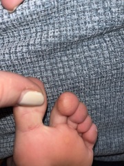 What is this on my child's toe (photos)