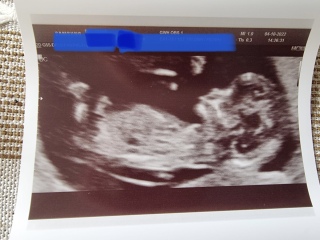Has anyone been told the gender at 12 week scan?