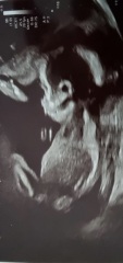 Does this look like a Boy to you?