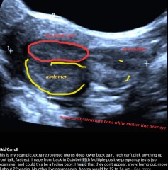 Due May 2023 - thread two